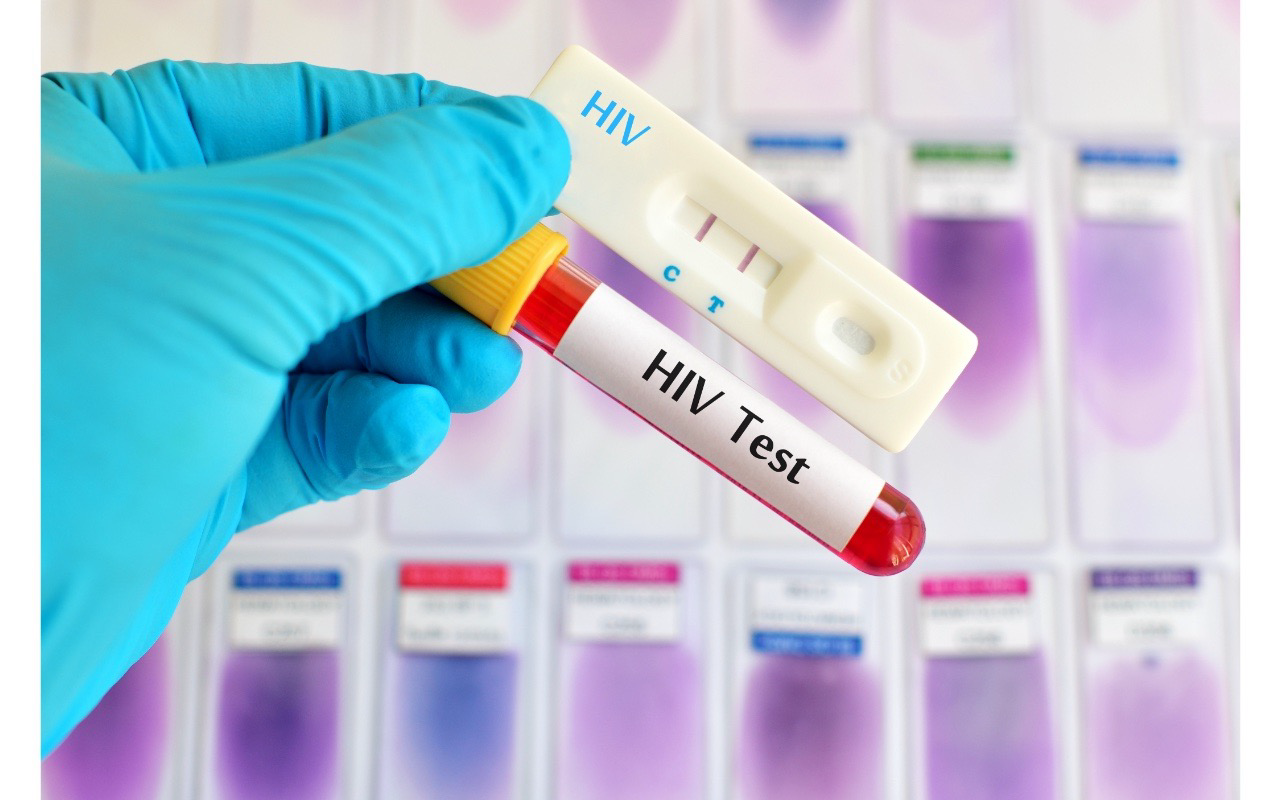 The Latest Advances in HIV Treatment: What You Need to Know in 2025