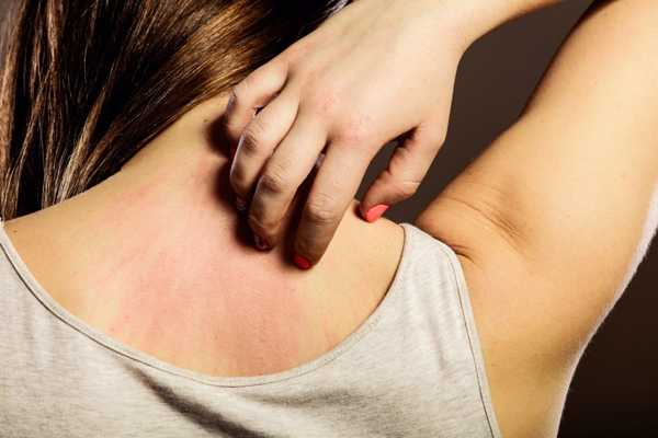 Understanding HIV-Related Skin Rashes: Key Information You Should Know