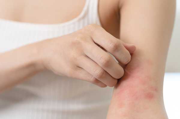 6 Common Causes of Skin Rashes: How to Identify and Treat Them