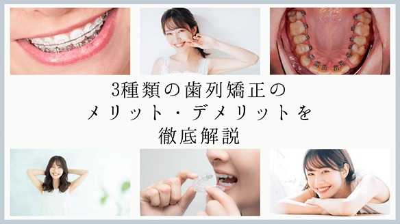 【完全版】歯列矯正で理想の笑顔に！痛くない最新治療・人気クリニック・成功事例まで徹底解説