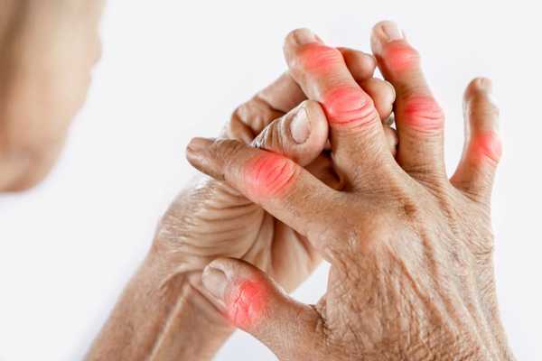 The most effective arthritis treatments (2025) and arthritis pain will disappear!